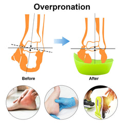 FiotSkep orthotic insole in running shoe demonstrating everyday use