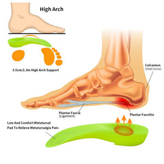 FiotSkep orthotic insoles worn inside everyday shoes for all-day support.