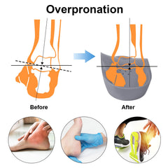 FiotSkep inserts help many users feel more stable and comfortable throughout the day.