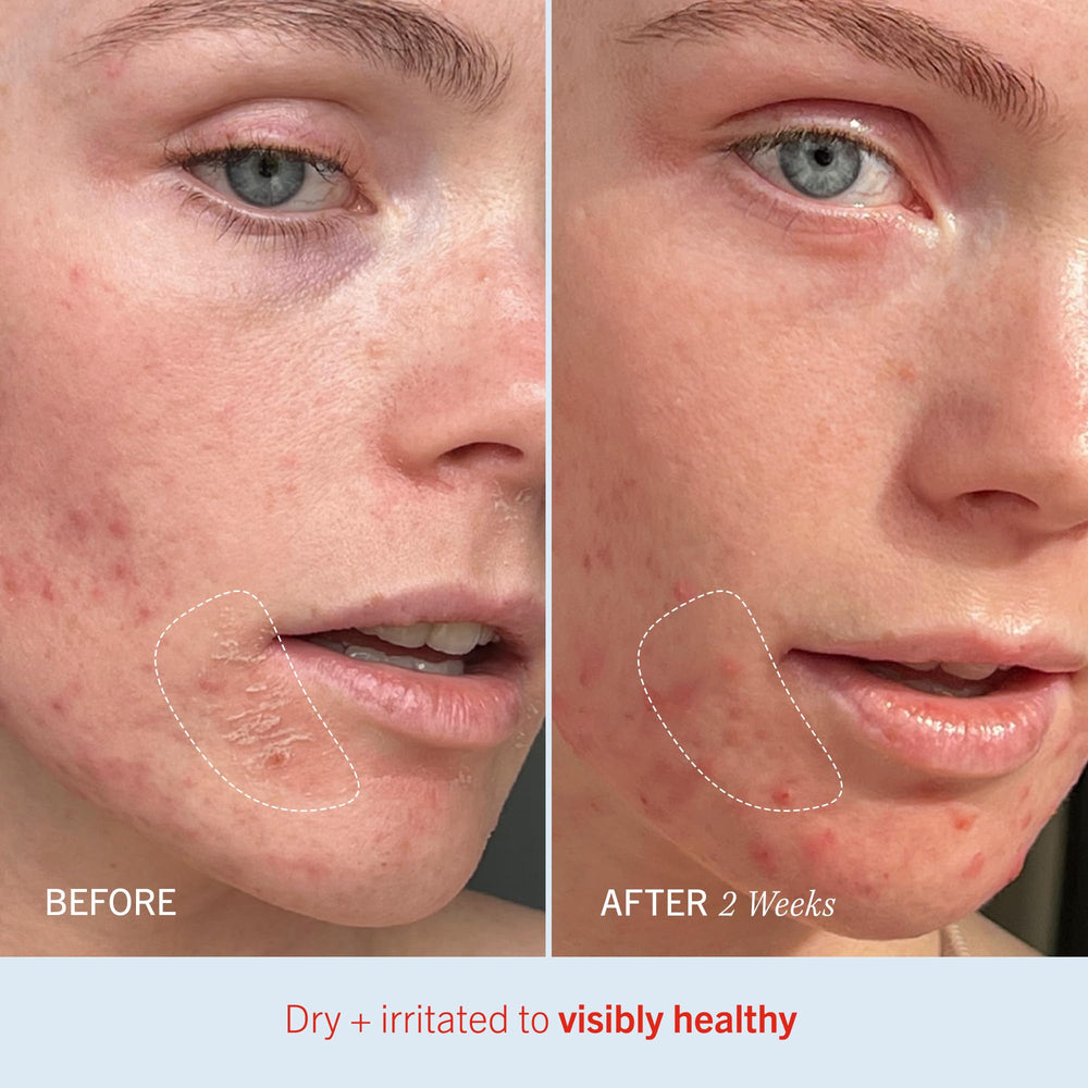First Aid Beauty Ultra Repair Cream free-from formula excludes fragrance and alcohol.