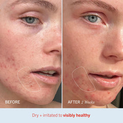 First Aid Beauty Ultra Repair Cream free-from formula excludes fragrance and alcohol.