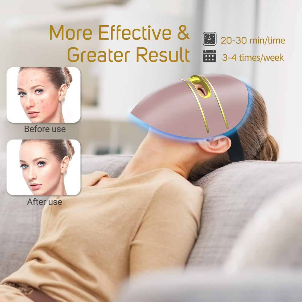 F FIWENE blue light LEDs target breakouts for calmer skin