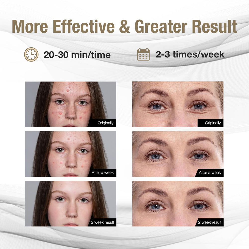 Fiwene LED mask close-up highlighting soft skin contact and gentle fit.