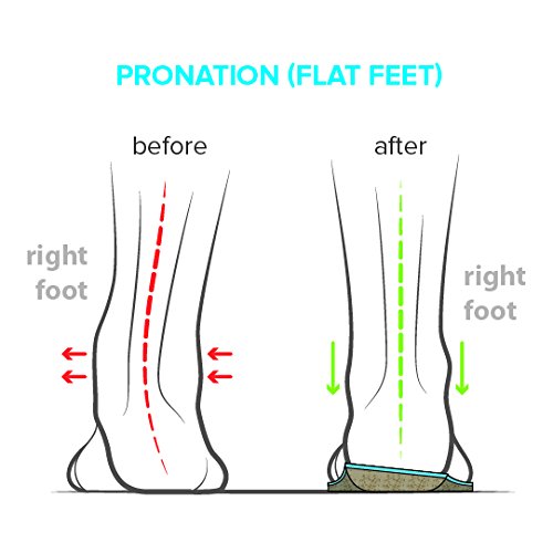 FootScientific Arches Type 1 Stay Dry mesh helps moisture and odor control.