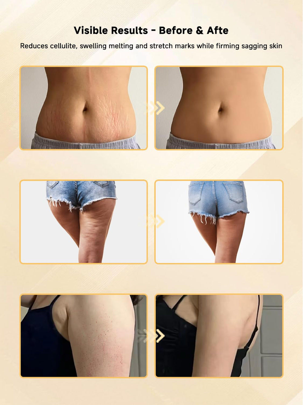 GDQ use with body lotion or conductive gel enhances glide and results.