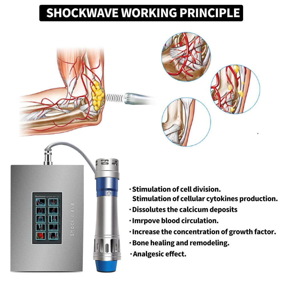 Generic Extracorporeal Shockwave foot and heel treatment supports plantar fasciitis care.