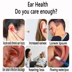 Generic Tinnitus Relief outer-ear application demonstrates gentle care for daily use.