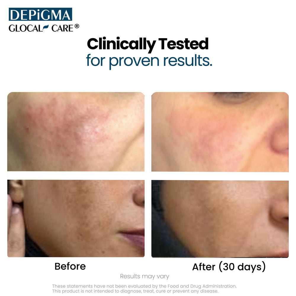 GlocalCare Depigma Setria L-Glutathione highlights antioxidant support.