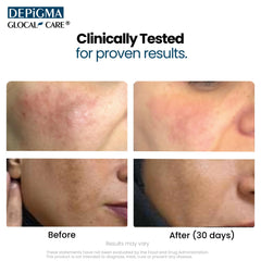 GlocalCare Depigma Setria L-Glutathione highlights antioxidant support.