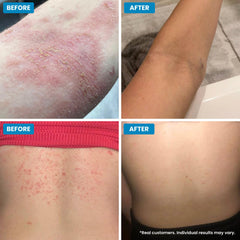 Texture close-up highlighting nourishing ingredients for sensitive skin.