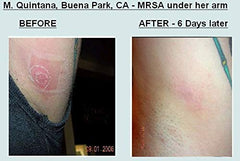 Grandma's Pine Tar Salve used by people and pets for skin care and minor irritations.
