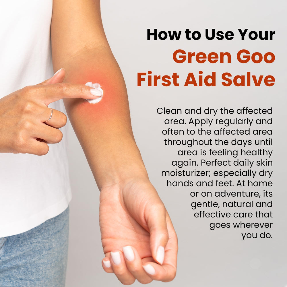 Green Goo on hand demonstrates portable, travel-friendly first aid.
