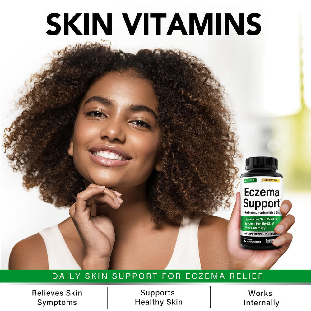 Greenford Eczema Support label close-up highlighting natural ingredients and gentle care.