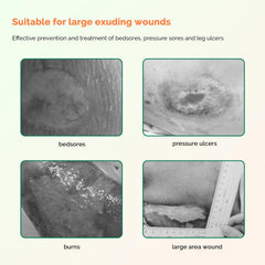 Greetmed sacral wound care dressing applied to sacral area in clinical setting