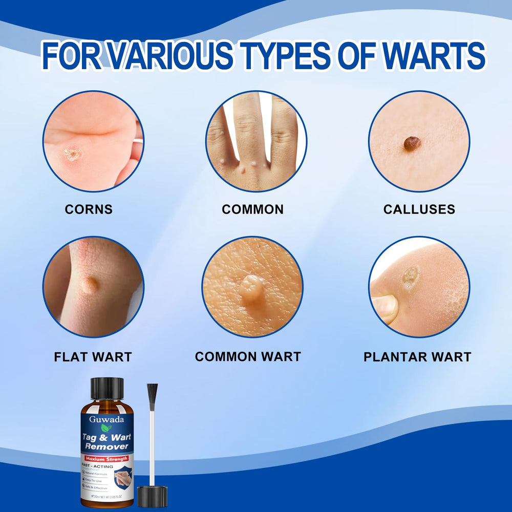Guwada Skin Tag Removal precision tip—easy control for selective treatment.