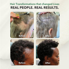 HairSmart ingredients chart highlights components and scalp health benefits