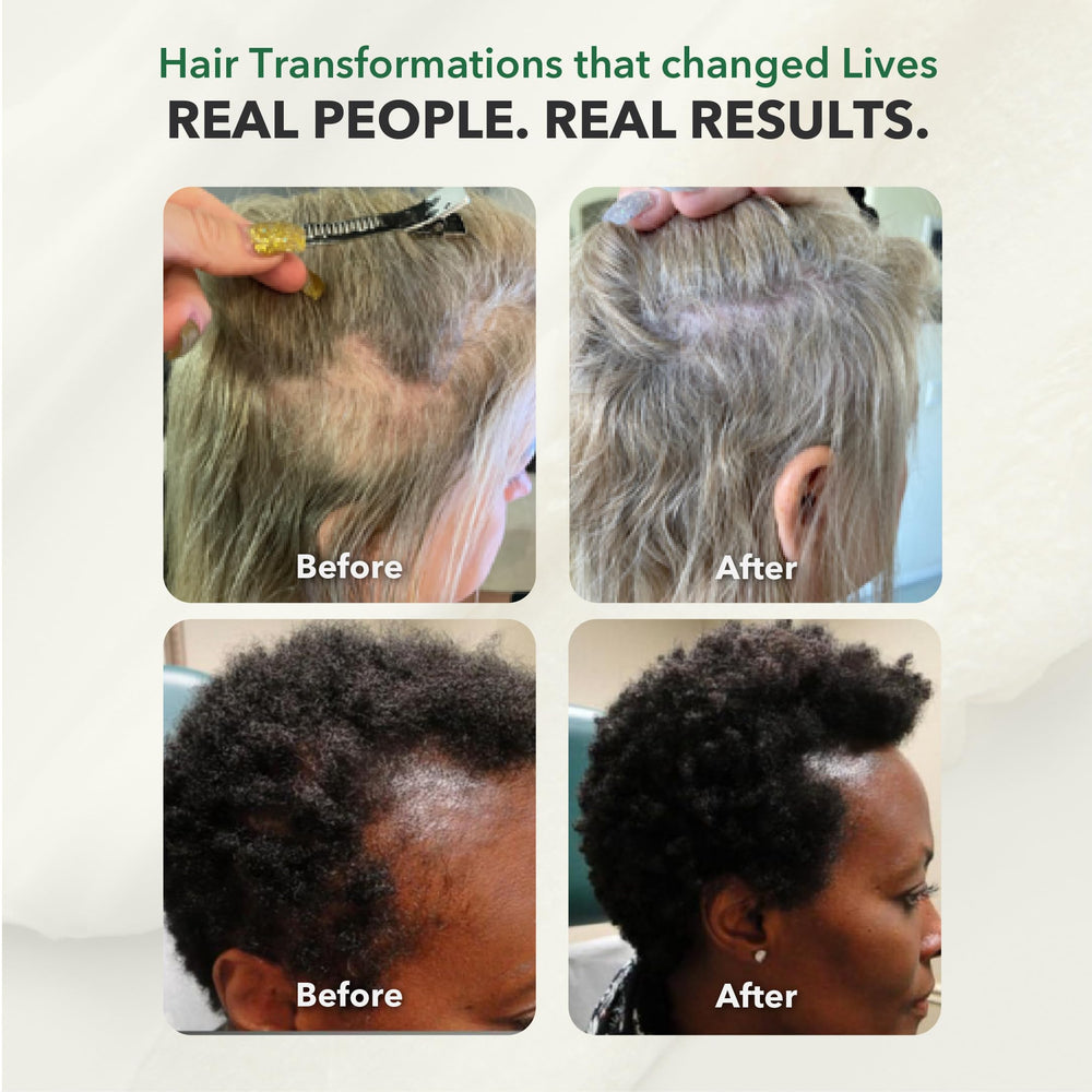 HairSmart DHT Blocker vegan-friendly stamp signals plant-based supplementation.