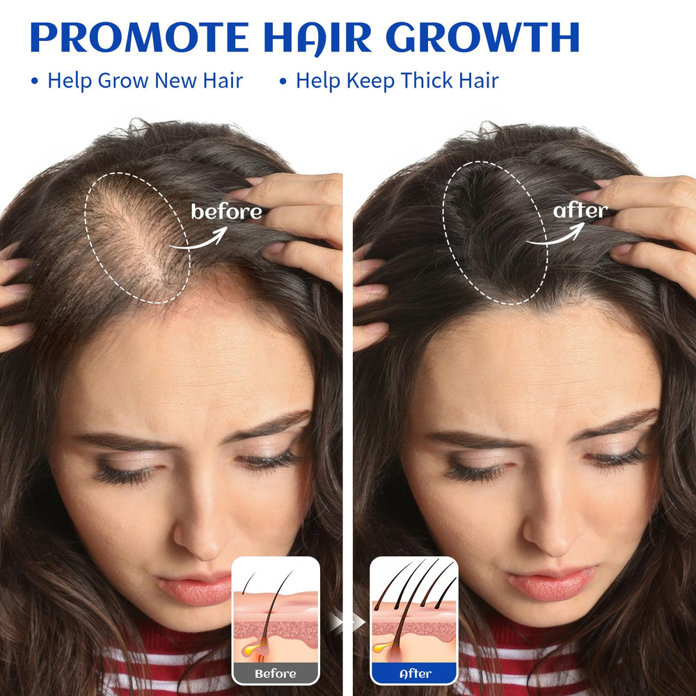 HIQILI rosemary oil bottle shown with shampoo blend for hair nourishment