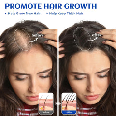 HIQILI rosemary oil bottle shown with shampoo blend for hair nourishment