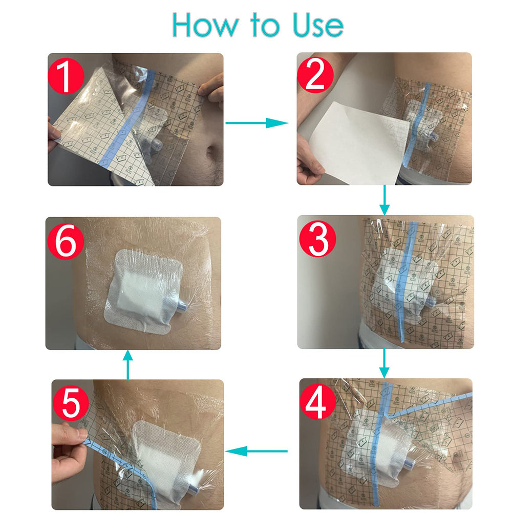 Hola Health disposable moisture barrier shields skin and tubing during showers.