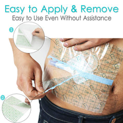 Hola Health peritoneal dialysis G-tube shield protects chest sites in shower.