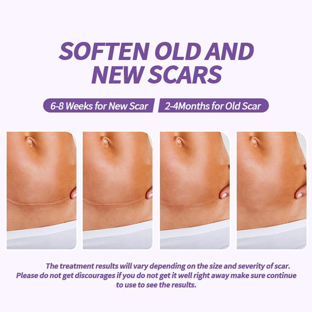 HPUFKOT surgical scar coverage demonstrates flexible at-home protection