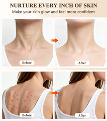Icbgre red light therapy mask chest area for broad coverage and comfort.