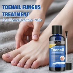 IFUNSHAR home care set ready for routine nail care.
