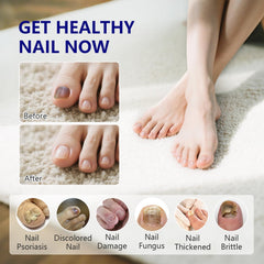 iKeener travel-friendly nail pen fits in gym bag