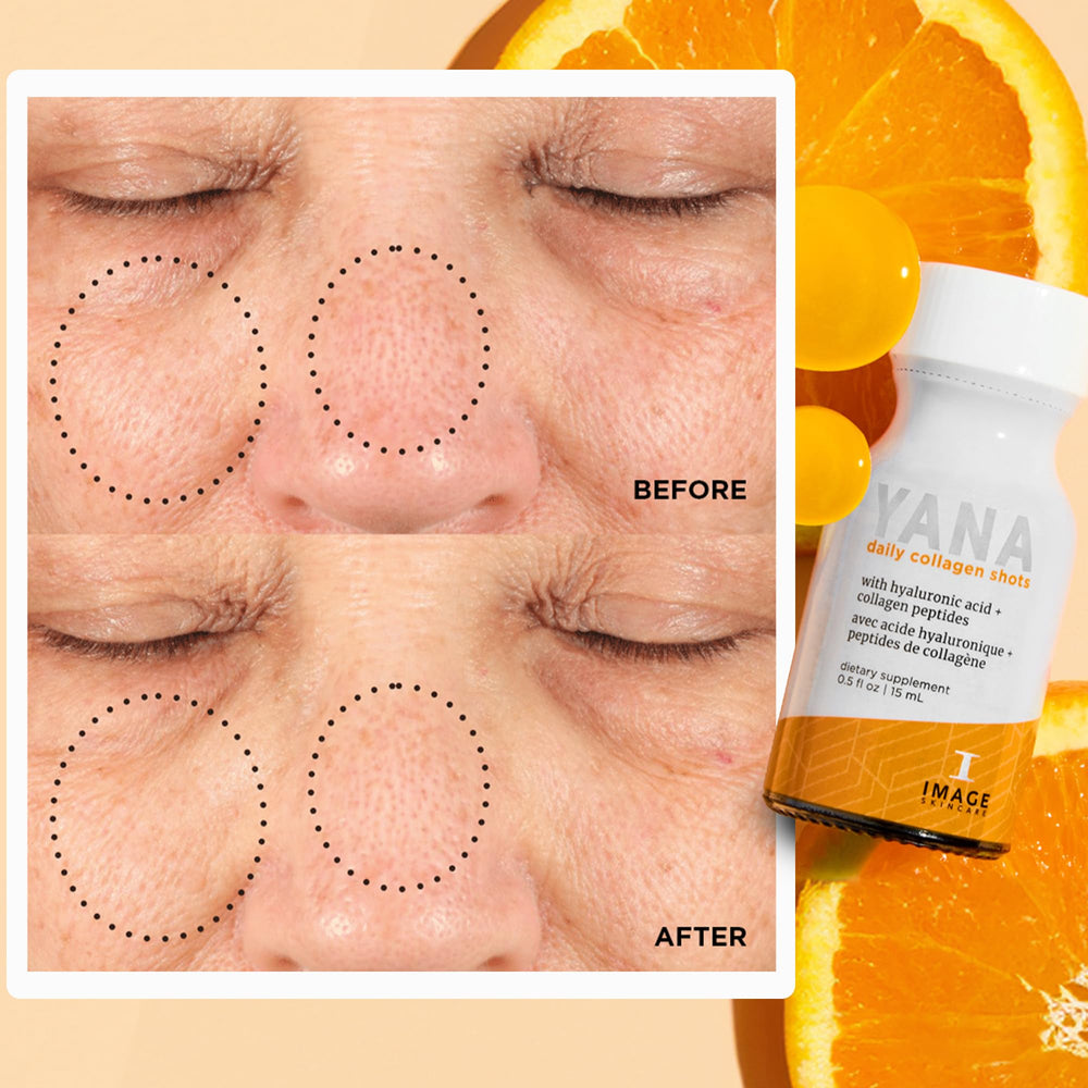 IMAGE Skincare YANA ingredients feature organic acai and pomegranate juices.
