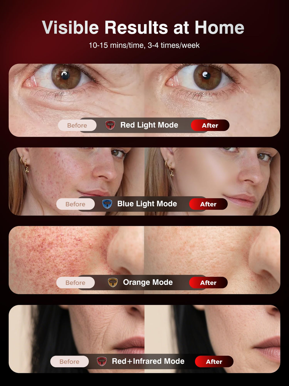 INTEO 328 high-energy LEDs ensure dense coverage on the face.