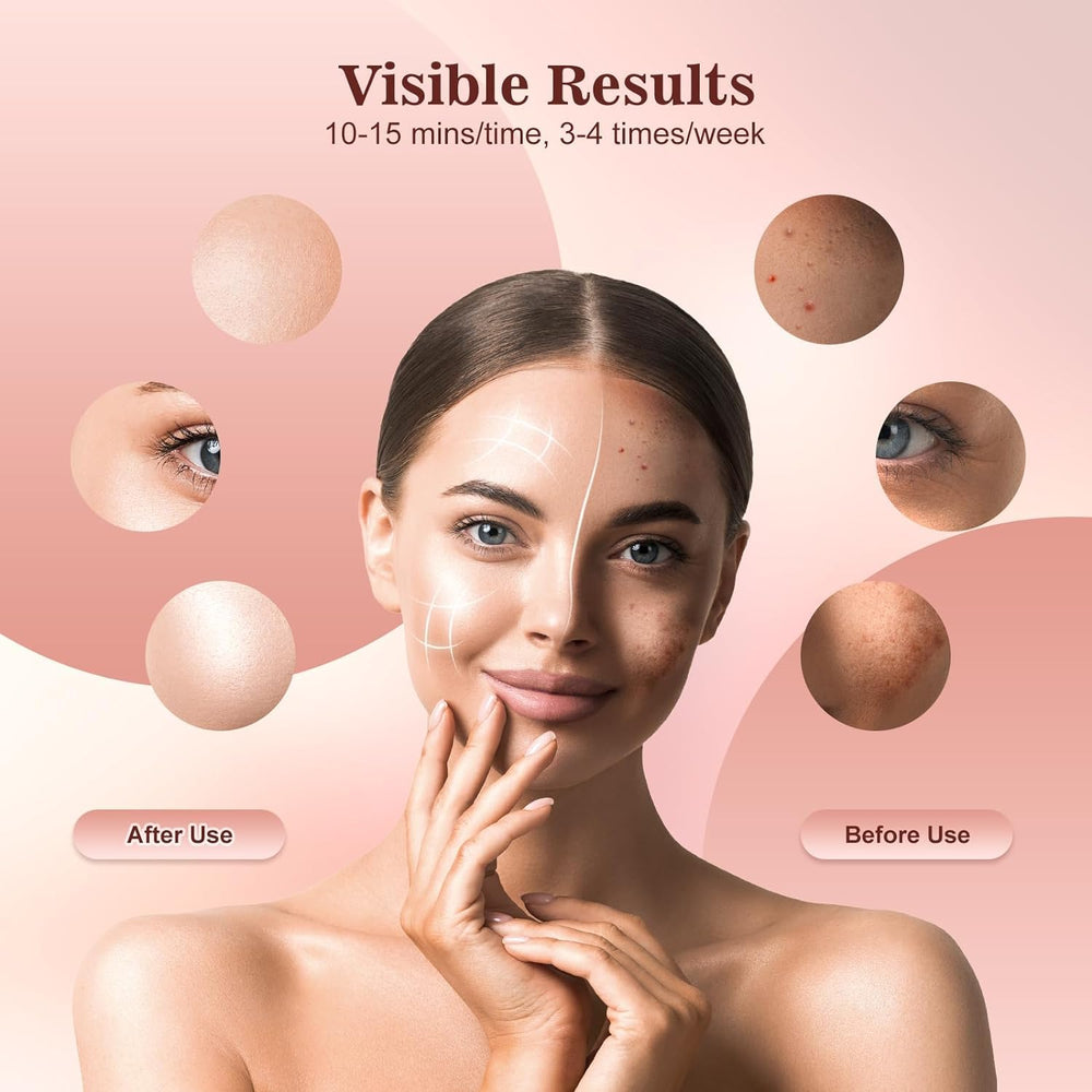 INTEO red light mask compact portable design for travel skincare.