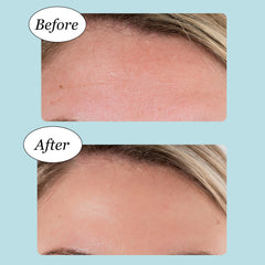 Jane Vine deep hydration formula patch with collagen and hyaluronic acid
