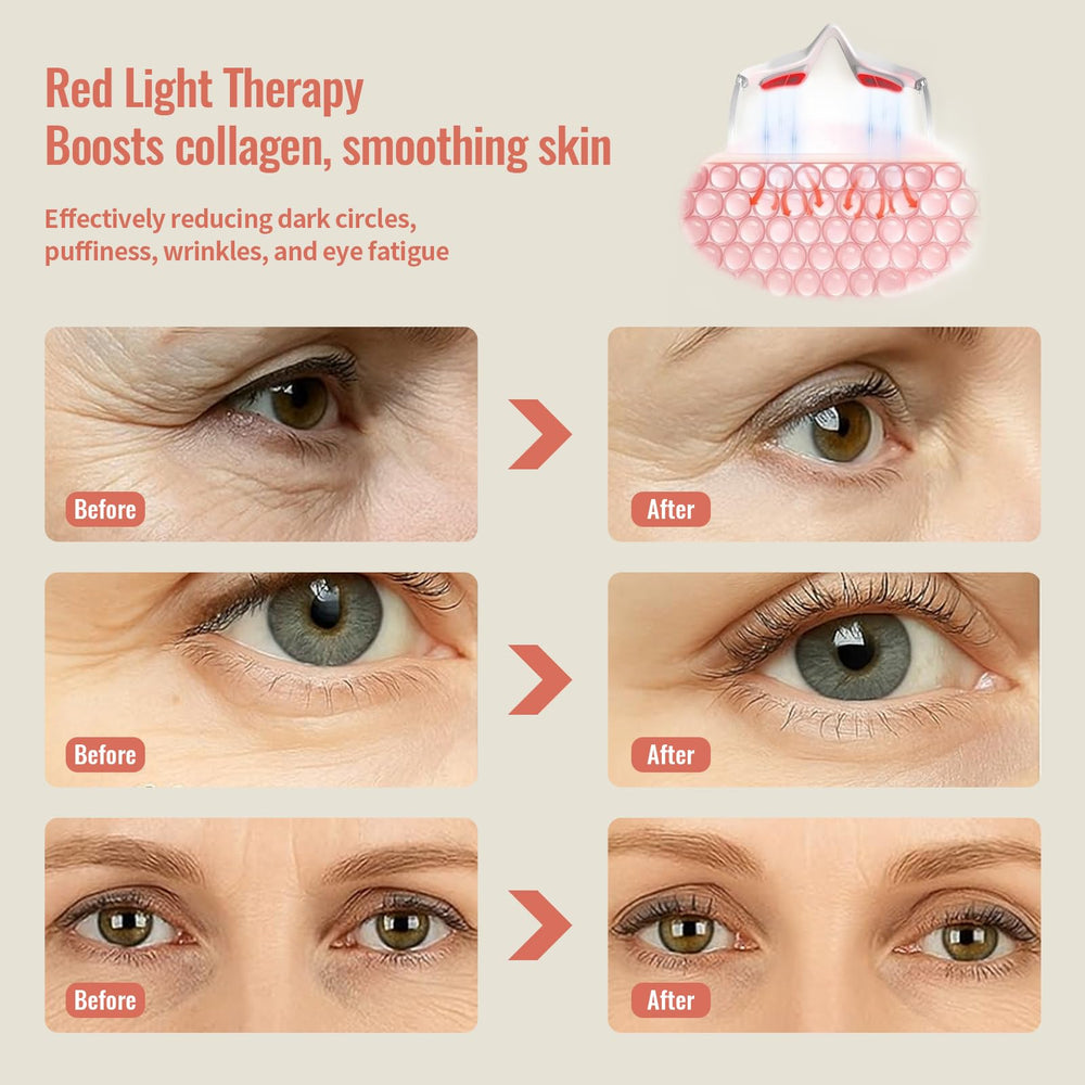JCOTTON microcurrent eye massage targets puffiness around the eyes
