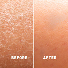 Just Nutritive Aloe Vera application scene suggests soothing relief for skin.