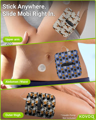 KOVOQ 4‑way stretch fabric sleeve during active use.