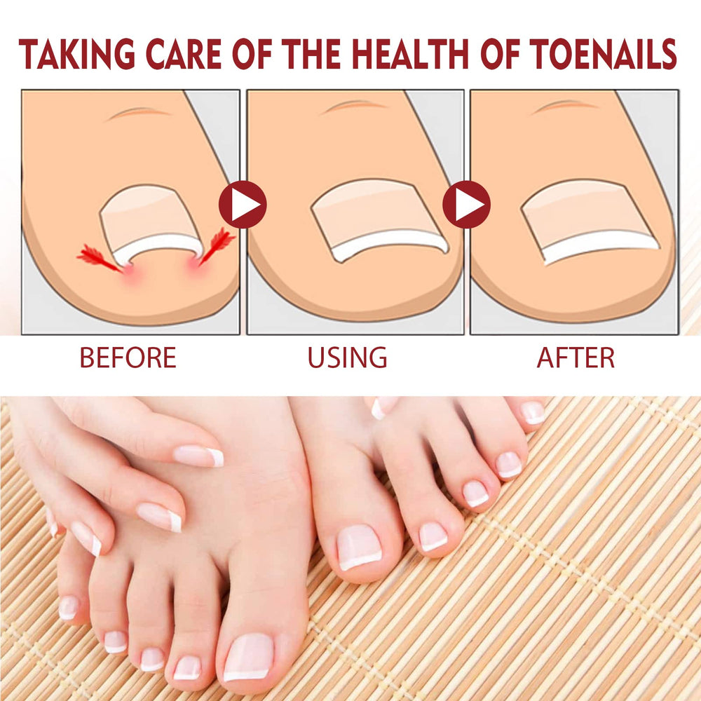 KUNLEN 2-pack packaging; convenient carry for on-the-go nail care.