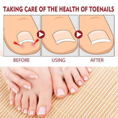 KUNLEN 2-pack packaging; convenient carry for on-the-go nail care.