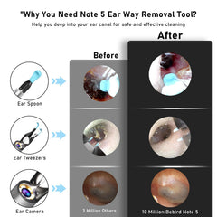 KWYBOW Note5 ear pick tweezers allow safe extraction of debris.