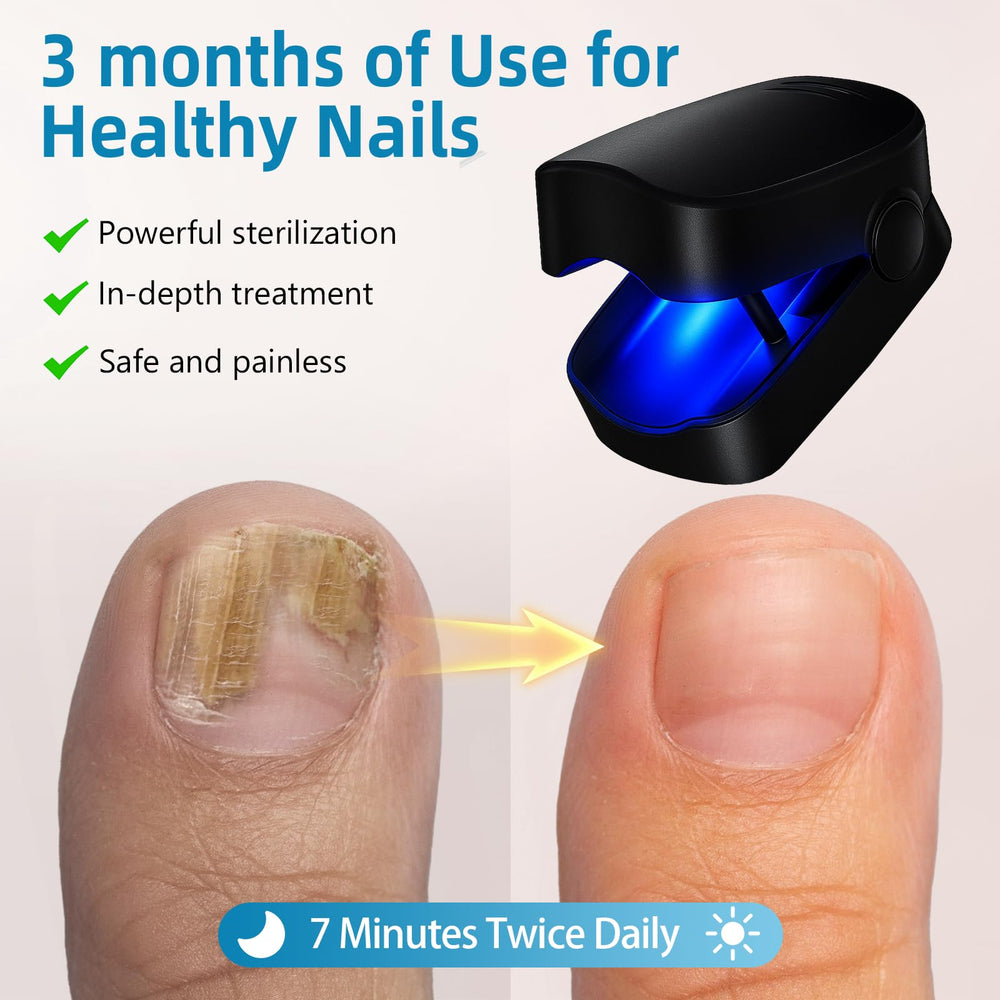 Leeyond device in use on a toenail for convenient home therapy