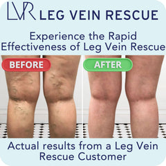 LEG VEIN RESCUE diosmin complex with high bioavailability