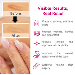 LIPOELASTIC compact tube packaging for easy on-the-go scar care.