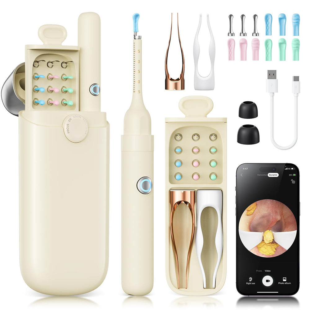 Loyker ear-wax removal with 1080p camera shows real-time ear view.