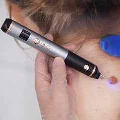 Lrxveio Skin Clinic probes and needles enabling precise wart and skin tag treatment