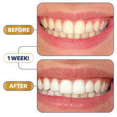 Lumineux Longevity daily routine setup for a brighter smile