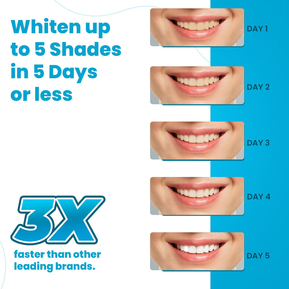 Lumist Advanced Teeth Whitening Strips application closeup demonstrates comfortable fit for even coverage