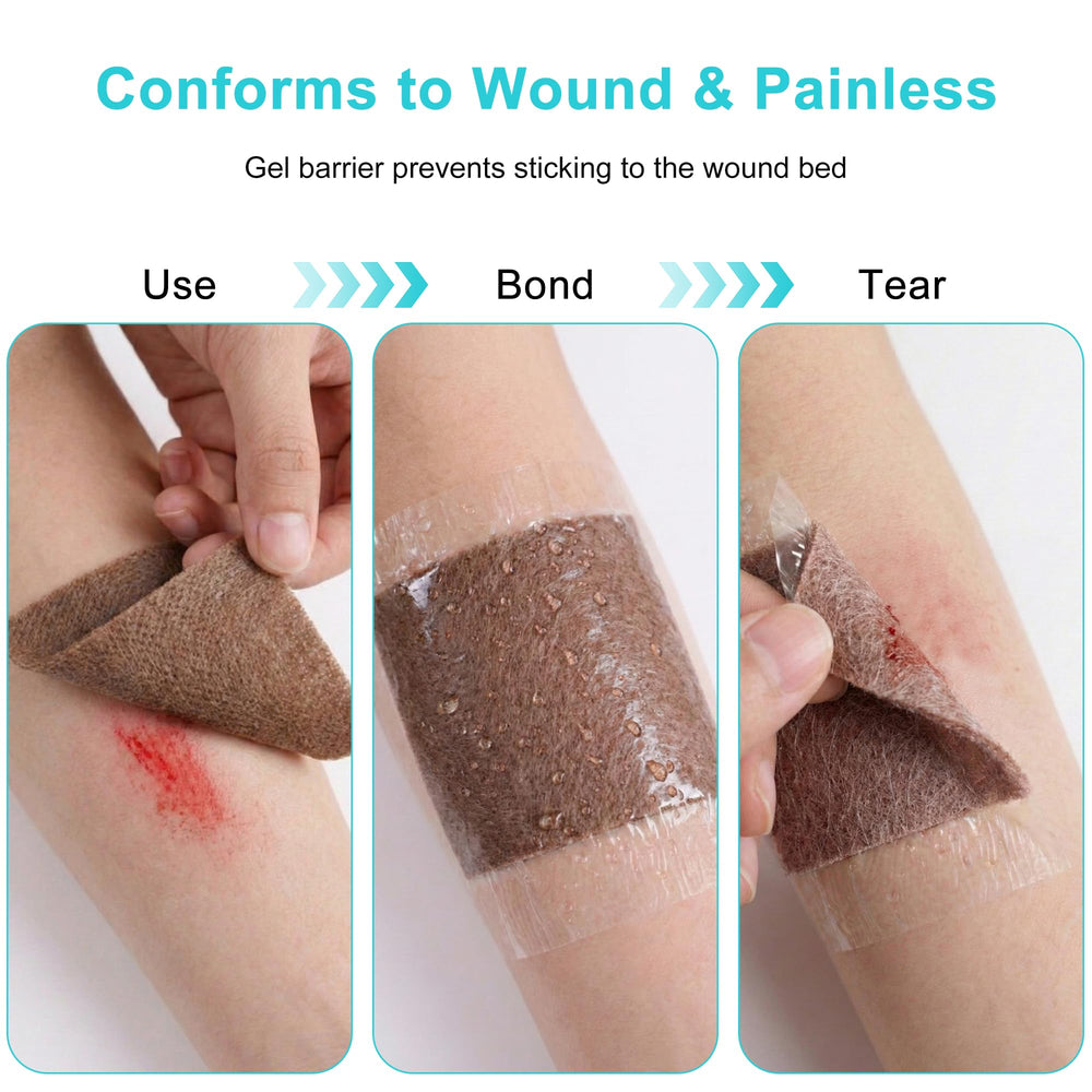 Lvonge single-use wound patch packaging ensures sterile, convenient replacement