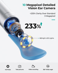 Lygee 10MP HD lens with six LEDs delivers clear ear visualization.