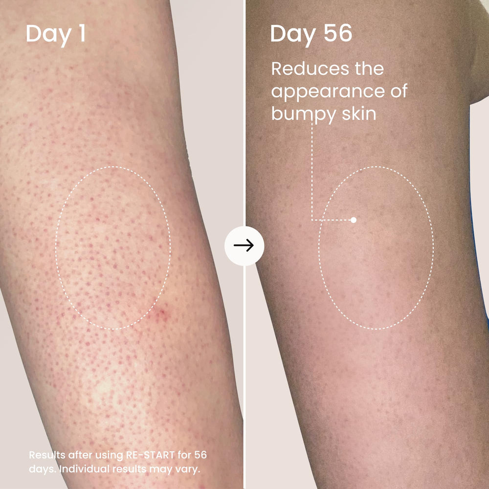 Maelys RE-START jar label for at-home treatment.
