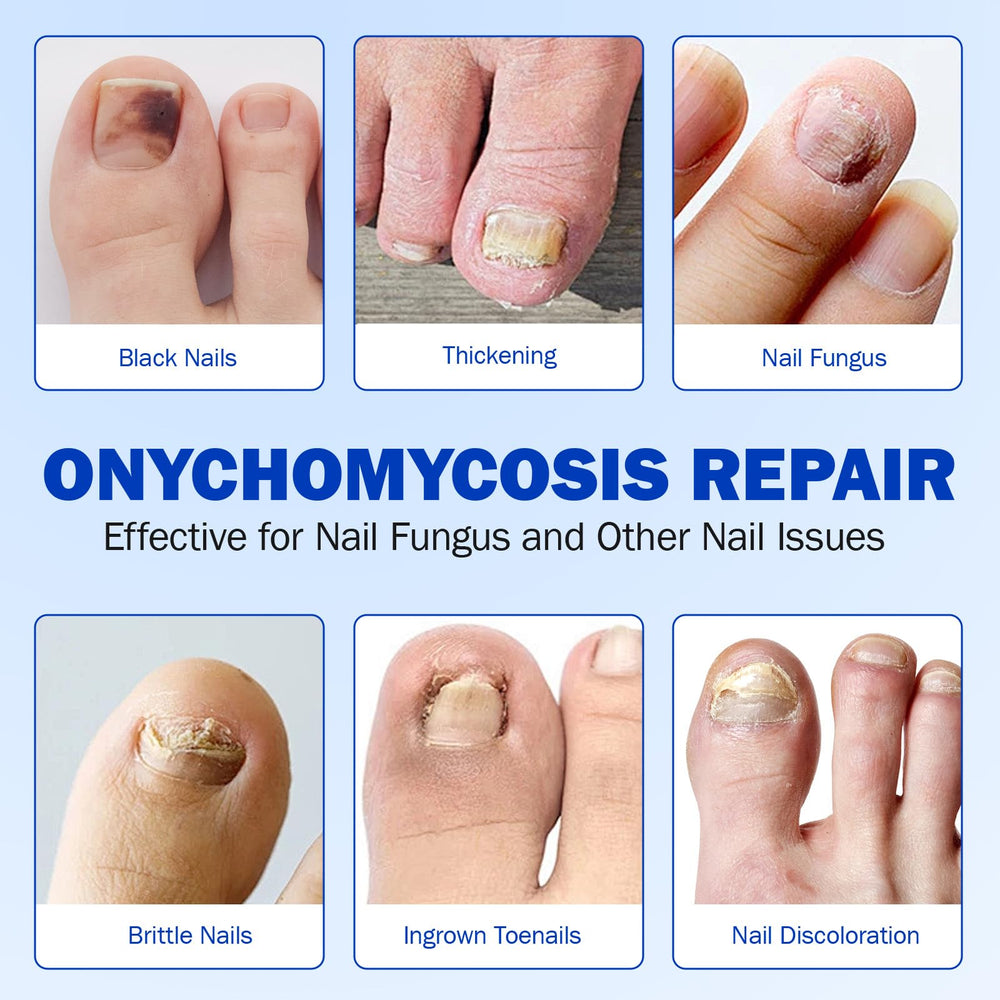Mcukv toenail patches sleep-care routine fits nightly schedule.